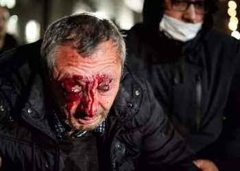 “თვალების დათხრა ქოცური ხელწერაა!” – ქაცარავა