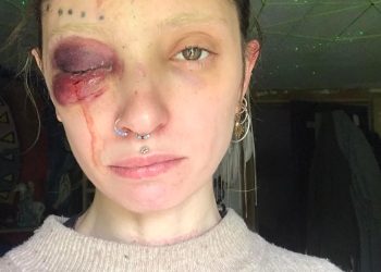 ,,ბევრი ვიფიქრე ეს გამეკეთებინა თუ არა და ხმამაღლა მესაუბრა თუ არა..“