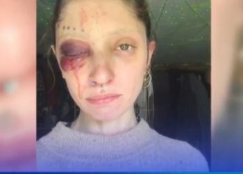 ალკოჰოლური თრობისას, ცივი იარაღით ცდილობდა შალვა იაშვილის დაზიანებას – ადვოკატი ბეგიაშვილზე