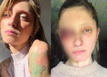 „ვინც ფიქრობს, რომ თავი დავიზიანე, მაგიდა ვირტყი და თავი კედელს ვურტყი…“ – რას წერს რენატა ბეგიაშვილი