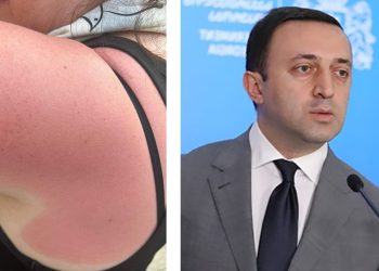 “ცოცხლად დამწვეს, არც ჩრდილში დაჯდომის უფლება მომცეს… რა მოხდებოდა ერთი სკამი დამედგა” – თამარ იარაჯული