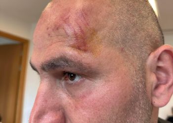 ,, ზაზას საგარეჯოს საკრებულოს წევრების მიერ ნასროლი ქვა მოხვდა თავში” – ლევან ხაბეიშვილი