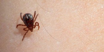 ახალციხეში ყირიმ–კონგოს ახალი შემთხვევა დაფიქსირდა