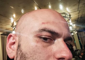 ,,ეს ბათუმის კრიმპოლის უფროსის ირაკლი დგებუაძის ფეხის კვალია” – გენრი დოლიძე