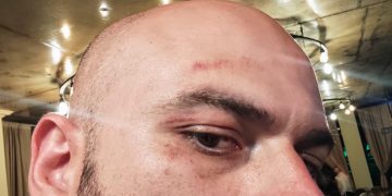 ,,ეს ბათუმის კრიმპოლის უფროსის ირაკლი დგებუაძის ფეხის კვალია” – გენრი დოლიძე