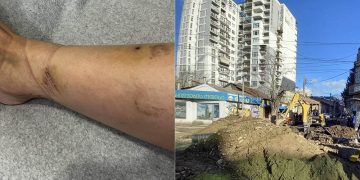 “გადავრჩი” კოჭის ბზარით – გაუფრთხილდით თავებს” – რა მოხდა წერეთლის გამზირზე? – წერილი სოციალური ქსელიდან