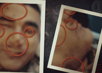 ნაწამები, გარდაცვლილი ჯარისკაცი ტყეში – “სამ სამხედროს, რომელიც აწამებდა, გაექცა და ჩამომხრჩვალი იპოვეს”