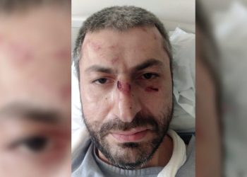 “პირდაპირ ჩემ სახეზე გაატარეთ აწი ევროპა” – რას წერს აქციის დაშლის დროს დაშავებული მოქალაქე?