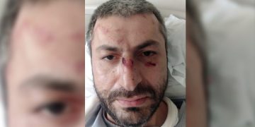 “პირდაპირ ჩემ სახეზე გაატარეთ აწი ევროპა” – რას წერს აქციის დაშლის დროს დაშავებული მოქალაქე?