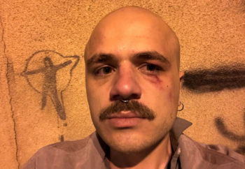 “ცდილობდნენ სახეში და თავში დამიზნებით დარტყმას” – ჟურნალისტი გიორგი ბასხაჯაური