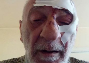 “ეს კარგი ადამიანი ცემეს, თქვენი ბო@ დედებს შევეცი” – თბილისში 62 წლის კაცს თავს დაესხნენ