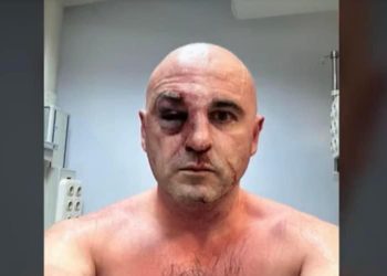 სასტიკად ნაცემი ლევან ხაბეიშვილი ინგოროყვაშია გადაყვანილი