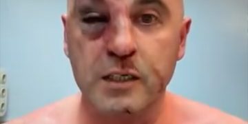 სასტიკად ნაცემი ლევან ხაბეიშვილი ინგოროყვაშია გადაყვანილი