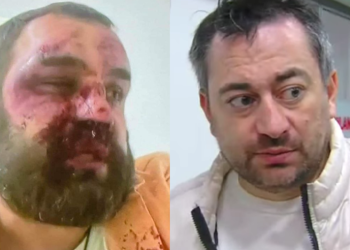 ჩემი მეზობელია, დიმას ღრიალი გავიგე, სასტიკად არის ნაცემი, მე წამოვიყვანე საავადმყოფოში – ვატო წერეთელი