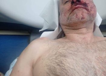 პოლიციის მიერ სასტიკად ნაცემი დავით ქაცარავა