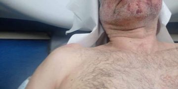 პოლიციის მიერ სასტიკად ნაცემი დავით ქაცარავა