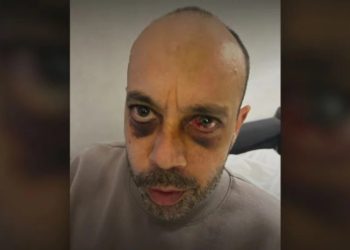 „ოთხმა ფორმიანმა სცემა, ტვინში ჰემატომა აქვს, შაბათს უტარდება ოპერაცია“ – ანტირუსულ აქციაზე ნაცემი აშშ-ის მოქალაქის მდგომარეობა მძიმეა