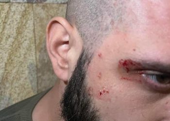 “მცემეს, მეც ვუტყი, მე მიცდი შე ბო@ო-თქო დავუყვირე და დამალულებიც გამოხტნენ” – ბორის ჩელე ყურუა