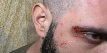 “მცემეს, მეც ვუტყი, მე მიცდი შე ბო@ო-თქო დავუყვირე და დამალულებიც გამოხტნენ” – ბორის ჩელე ყურუა