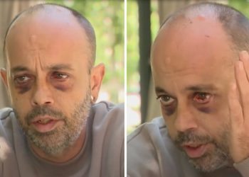 “აქ თავს უსაფრთხოდ აღარ ვგრძნობ” – აქციაზე ნაცემი აშშ-ს მოქალაქე