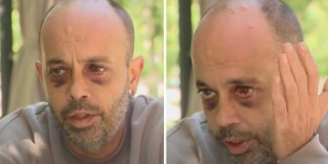 “აქ თავს უსაფრთხოდ აღარ ვგრძნობ” – აქციაზე ნაცემი აშშ-ს მოქალაქე