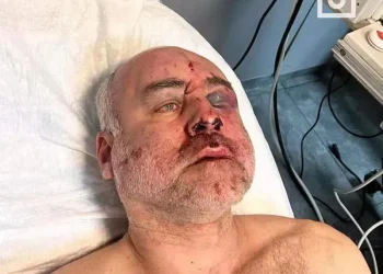 თვალბუდის ძვალი მაქვს ჩამტვრეული, ასევე დამტვრეულია ზედა ყბა, ტვინის შერყევა საკმაოდ მძიმე ფორმის და სერიოზული ჰემატომები თავზე – ქაცარავას პირველი კომენტარი