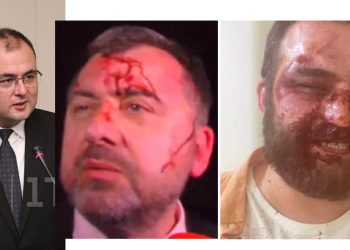 “არც ის ვიცი ვინმემ თავის თავი იცემა თუ…” – იუსტიციის მინისტრი