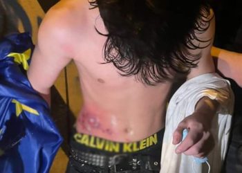 „არასრულწლოვანს რეზინის ტყვია ესროლეს“