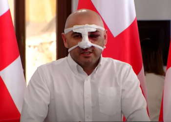 ლევან ხაბეიშვილი: რამდენიმე წუთი მცემდნენ, ყველას შეგეხებათ ეს უსამართლობა