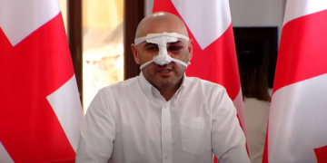 ლევან ხაბეიშვილი: რამდენიმე წუთი მცემდნენ, ყველას შეგეხებათ ეს უსამართლობა