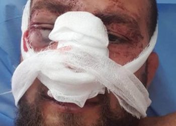 სასტიკად მცემეს, ნაციონალს მეძახდნენ” – პირველი ინტერვიუ სასტიკად ნაცემ აქტივისტთან