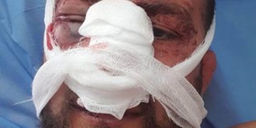 სასტიკად მცემეს, ნაციონალს მეძახდნენ” – პირველი ინტერვიუ სასტიკად ნაცემ აქტივისტთან