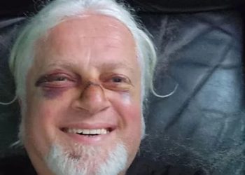 “მორიგი სიკვდილისთვის თვალებში ჩახედვა და ახალი მიკერებული ცხვირი” – მუსიკოსი ლადო ბურდული ავარიაში მოყვა