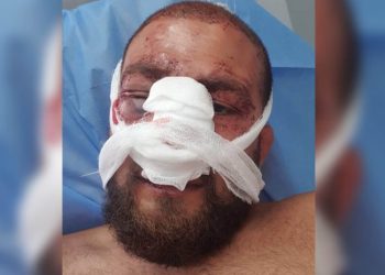 “ლერი დარჯანიას ოცნების “ტიტუშკები” დახვდნენ და ფიზიკურად გაუსწორდნენ” – აქტივისტი დათუნა დანელია