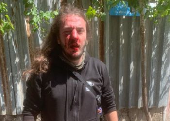 აქტივისტ ზუკა ბერძენიშვილს თავს დაესხნენ