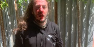 აქტივისტ ზუკა ბერძენიშვილს თავს დაესხნენ