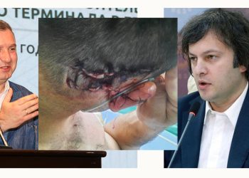 ვინ არის პროტესტენზე თავდასხმისთვის დაკავებულები და რა კავშირში არიან პრემიერის გუნდთან – მედია