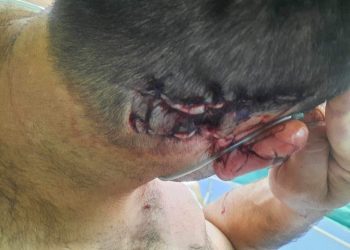 თავდასხმა, დაჭრა – ბალდაში პროტესტანტებს შეიარაღებული პირები გაუსწორდნენ