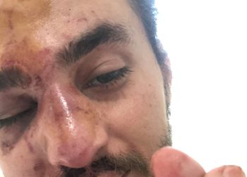 არ გამოკითხულა კამერიც მფლობელი – კიდევ ერთი თავდასხმა, რომლის გამოძიებასაც შსს არ “ჩქარობს”