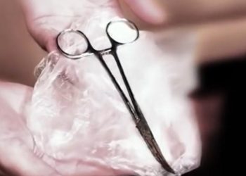 “ასე ვატარებდი მაკრატელს 2 წელი მუცლით, ელენთა ამოიღეს და “ზაჟიმი“ ჩამიტოვეს“ – რას ჰყვება პაციენტი და რას პასუხობს მას ექიმი?