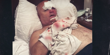 სისხლიანი ანგარიშსწორება კრივის ჩემპიონატზე – ქართველი მწვრთნელები ერთმანეთს დაუპირისპირდნენ