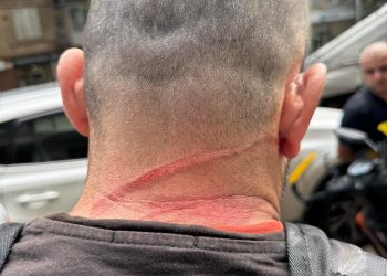 ,,რკინის მავთული ყელზე შემოეხვია, ლამის დაიხრჩო და პატრულმა 250 ლარით დააჯარიმა!” – შემთხვევა ცინცაძის ქუჩაზე