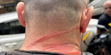 ,,რკინის მავთული ყელზე შემოეხვია, ლამის დაიხრჩო და პატრულმა 250 ლარით დააჯარიმა!” – შემთხვევა ცინცაძის ქუჩაზე