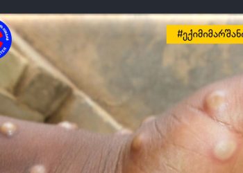 როგორია მაიმუნის ყვავილის პრევენციული ღონისძიებები, არსებობს თუ არა ვაქცინა და არის თუ არა პანიკის საფუძველი? – პირველადი დახმარების ცენტრი