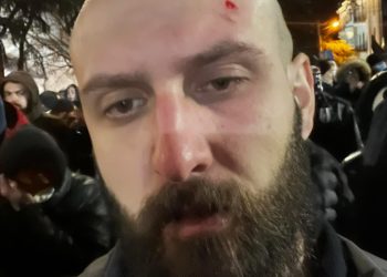 ,,მაგის სნაიპერი დედა@@ეცი…“ – ბორის ჩელე ყურუა