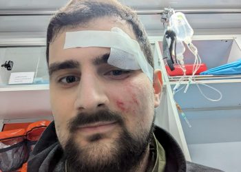 დამიმიზნეს და ტყვია მომარტყეს – საბა ბრაჭველი