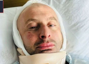 სპეცრაზმელის ძალადობის შედეგად, ჟურნალისტ გურამ როგავას სახის ძვლებისა და კისრის მალის რკალის მოტეხილობა აქვს