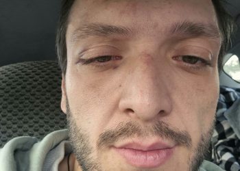 “ნაბი@ვრებო, იცით, ვინ სცემა გიორგი?” – ქურდობა, თავდასხმა, ცემა – რა ხდებოდა რუსთაველზე წუხელ?