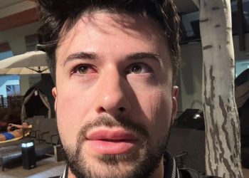 „ხალხო მიშველეთ, დავბრმავდი“ – გურამ შეროზია