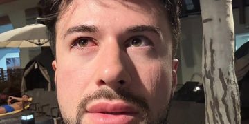 „ხალხო მიშველეთ, დავბრმავდი“ – გურამ შეროზია